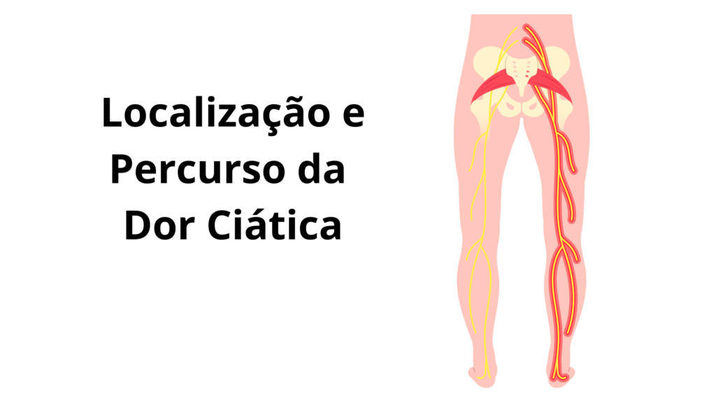 dor ciática