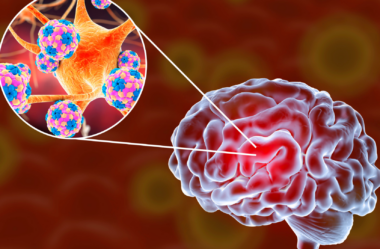 Meningite: Novas Diretrizes da OMS para o Tratamento
